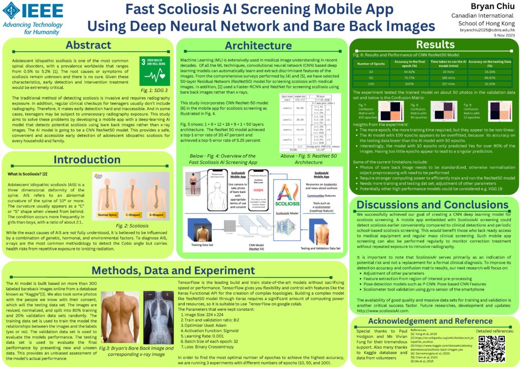 cdnis 4 checking for scoliosis using machine learned ai